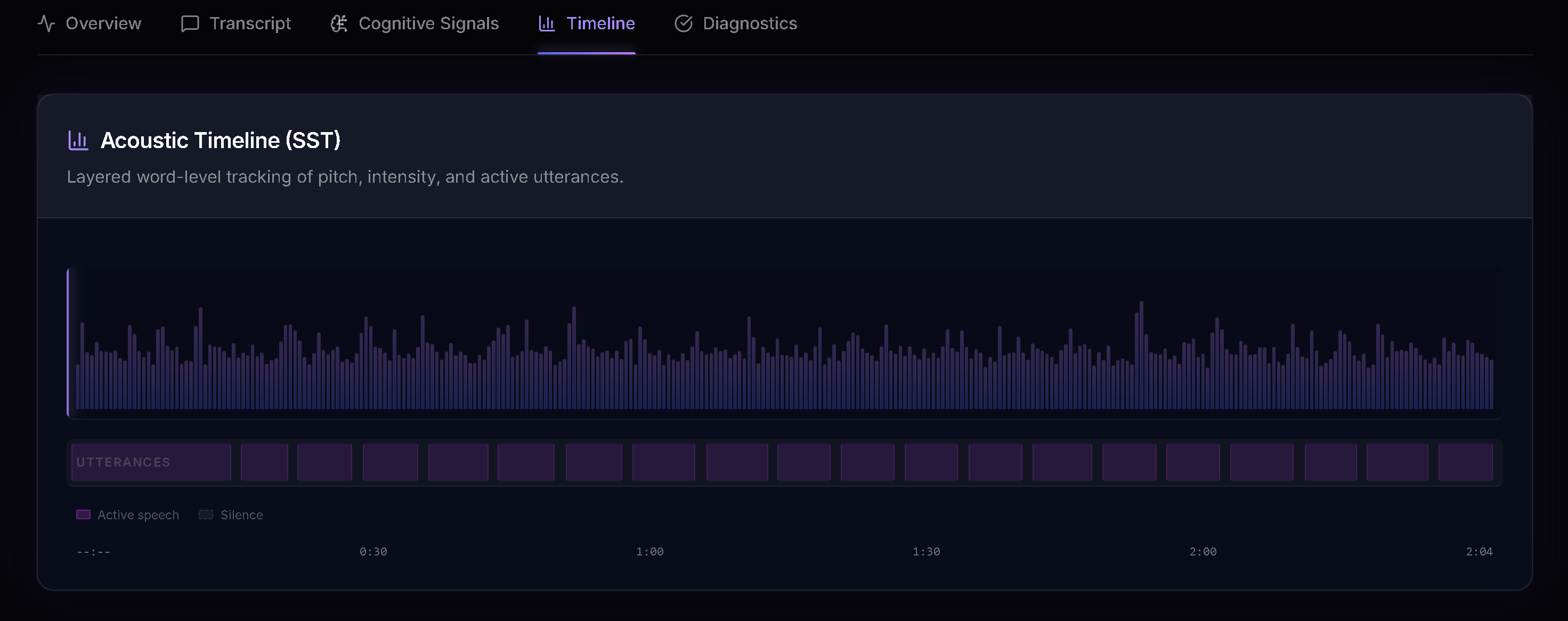 Auravoxa acoustic signal visualization showing timeline analysis